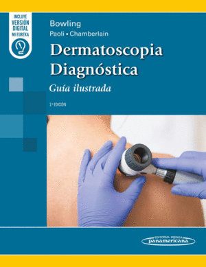 DERMATOSCOPIA DIAGNÓSTICA