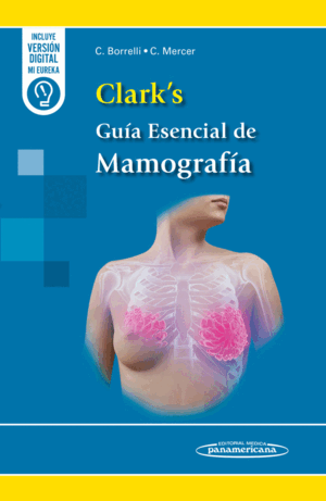 CLARK'S GUÍA ESENCIAL DE MAMOGRAFÍA