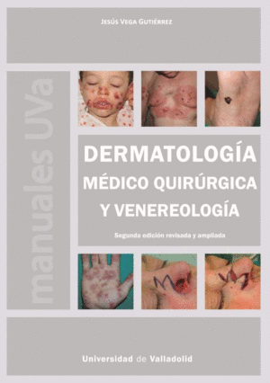 DERMATOLOGÍA MÉDICO QUIRÚRGICA Y VENEREOLOGÍA