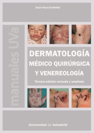 DERMATOLOGÍA MÉDICO QUIRÚRGICA Y VENEREOLOGÍA. TERCERA EDICIÓN REVISADA Y AMPLIA