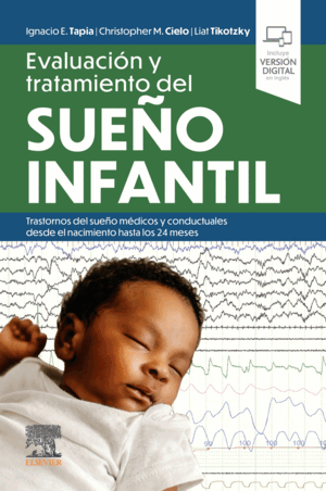 EVALULACION Y TRATAMIENTO DEL SUEÑO INFANTIL
