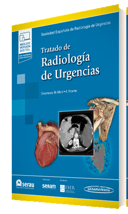 TRATADO DE RADIOLOGÍA DE URGENCIAS (EBOOK)