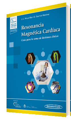 RESONANCIA MAGNÉTICA CARDÍACA (E-BOOK)