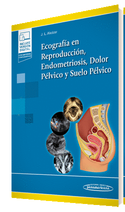 ECOGRAFÍA EN REPRODUCCIÓN, ENDOMETRIOSIS, DOLOR PÉLVICO Y SUELO PÉLVICO (E-BOOK)