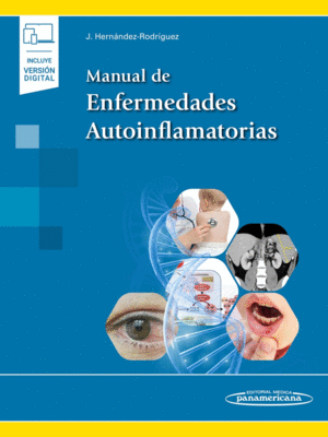 MANUAL DE ENFERMEDADES AUTOINFLAMATORIAS (E-BOOK)