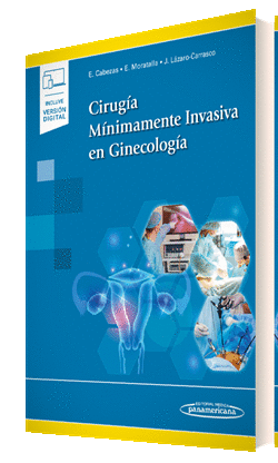 CIRUGÍA MÍNIMAMENTE INVASIVA EN GINECOLOGÍA