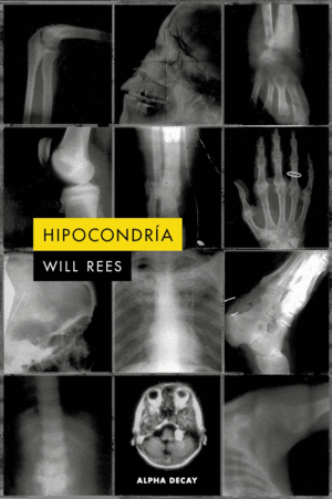 HIPOCONDRÍA